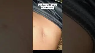 medical Unfit points ।। SSC GD ।। BSF tradesman ।। CRPF Paramedical ।। #bsf #sscgd @kumarsksir p-95