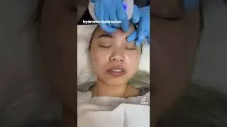 what a PAINFUL facial 😫