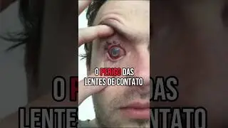 RISCOS OCULARES: Uso Incorreto de Lentes de Contato! #optometrista #optometria #miopia