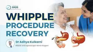 Do You Need Lifelong Medicines After Whipple Surgery? | Whipple Procedure Recovery | Dr Aditya