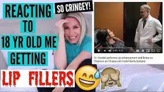 REACTING TO 18 YEAR OLD ME GETTING LIP FILLERS (SO CRINGEY!)