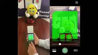 *Synch Views(& Instr.): Use SureScan 3D App and 3D Scan Mirror to Capture High Quality 3D Data *