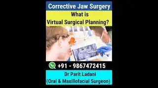 Virtual Surgical Planning in Jaw Surgery | Corrective Jaw Surgery