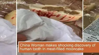 China Woman makes shocking discovery of human tooth in meat filled mooncake