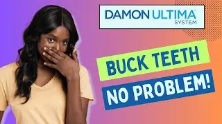 Buck Teeth No Problem with Damon Ultima Braces
