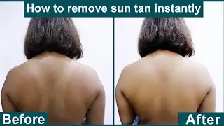 How to remove back tan?