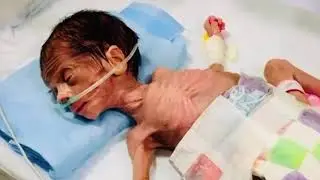 Cute baby feeding moments 👼😻@CuteNewbornBabies @neonatal_nurse 