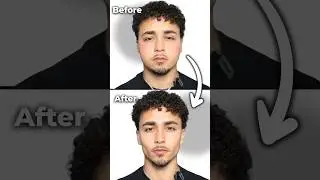 How Fix Your Bloated Face Instantly