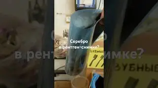 Есть ли СЕРЕБРО в рентген-снимке?