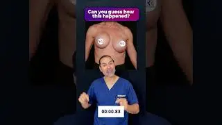 Как это произошло? 🤔 Вы не поверите, что было &laquo;после&raquo; этого &laquo;до&raquo;!