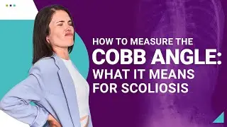How to Measure the Cobb Angle: What It Means for Scoliosis