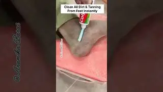 💯Clean All Dirt & Tanning From Feet Instantly/Sun Tanning Removal #shorts #skincare #skinwhitening