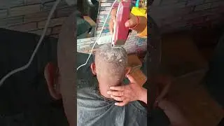 very disgusting dandruff #barbershop #haircut #shave #barber #satisfying #dandruff #hairstyle