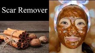 Scar Remover for Acne, Dark Spot & Body Scars| See the big difference after second use