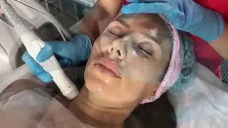 Power Shape по лицу Смоленск