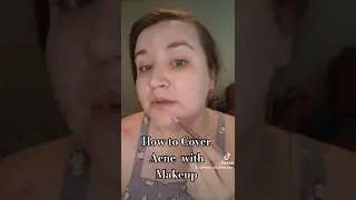 (ЛЕГКО) КАК ЗАСКРЫТЬ АКНЕ С ПОМОЩЬЮ МАКИЯЖА!