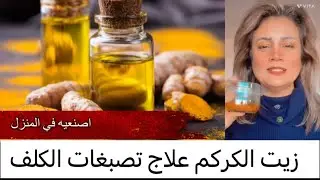 اصنعي زيت الكركم في المنزل، علاج فعال تصبغات الوجه والكلف د. لبينة الرحية
