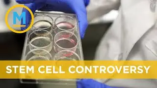 Canadian clinics offering unproven stem cell treatments | Your Morning