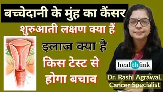 सर्वाइकल यानि बच्चेदानी के मुंह का कैंसर। Cervical cancer। Cause Symptom & Treatment । क्या है इलाज