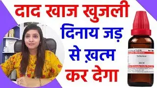 खुजली की दवा एवं उपाय | daad khaj khujli ki dawa | dinay ka dawa | dad khaj khujli medicine | Dinai