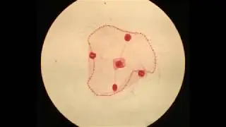 Obelia Life cycle - LAB : Cnidaria