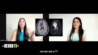 NeuroTv Tercera Temporada episodio 5  'C&oacute;mo interpretar una Resonancia Magn&eacute;tica cerebral '