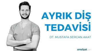 Ayrık Diş Tedavisi (Dt. Mustafa Sercan Akat)