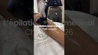 Laser 26 : L&rsquo;&eacute;pilation Laser pour une Peau Lisse et Pr&ecirc;te pour l&rsquo;&Eacute;t&eacute; ! 🌞✨