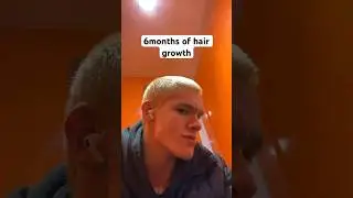 6 months of hair growth transformation