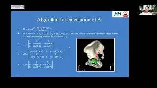 Functional Safe Zone Conversion to Coronal Plane Using an Algorithm: Failure of Lewinnek Safe Zone