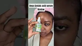 Anua azelaic acid 10 serum - one week result (before and after) #anua #azelaicacid #acneskincare