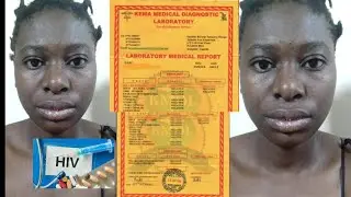 Kadaama Bbaawe Amusiize Siriimu/Abadde Aze Ku Vacation Ya 1month/Agenze Okola Medical Ayina Siriimu