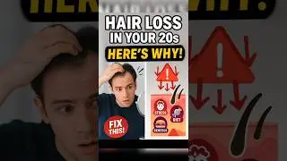 Hair Loss in Your 20s? Here&rsquo;s Why! #youtubeshorts #trending