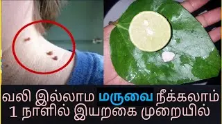 இதை தடவினால் மருக்கள் உதிர்ந்து தழும்புகள் இல்லாமல் ஆகிவிடும் | maru neenga iyarkai murai