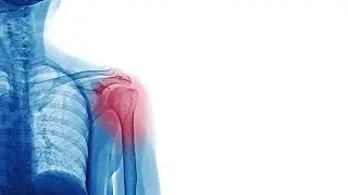 1 Sep 21: Dr Ian Thong & Anthony Hall - QScript Learning: Persistent pain or opioid use disorder?