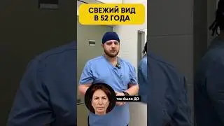 ВЕРНУЛА МОЛОДОСТЬ В 52 ГОДА🔥
