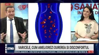 Sanatate  inainte de toate  19.06.2025   Dr. Iosif Balint. Produs revolutionar pentru varice.