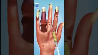 #asmr #asmrrelax #asmrshort #asmrtriggers #shortsasmr #asmrsound #asmrvideo#asmrgirl #asmrbeauty#ipl