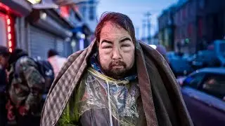 Kensington Philadelphia LIVE &mdash; The Dark Side of Americas Homeless Crisis