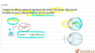 A student has difficulty reading the blackboard while sitting in the last row. What could be the...