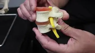 Lakes Chiro Back Injury