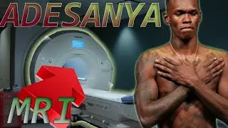 Adesanya Reveals he is getting a MRI for his Gynecomastia: Doctor reacts