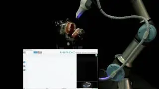 mirdc fast phase shift intra-oral scanner with UR robot