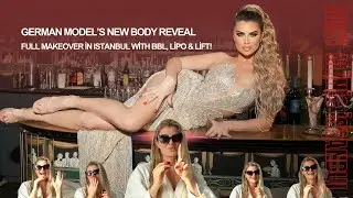 Famous German Model&rsquo;s Full Body Makeover in Istanbul! | BBL, Lipo 360 & Breast Lift at Best Clinic