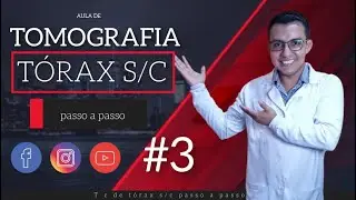 VÍDEO AULA DE TOMOGRAFIA DE TÓRAX SEM CONTRASTE#3 #RADIOLOGIA