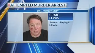 Man accused of burning wife