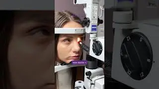 Say Goodbye to Dry Eyes with Punctal Plugs💧