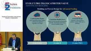 J  Kempfert  Self expanding valve