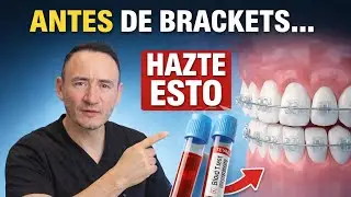 Don't get braces without these 5 tests!