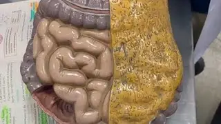 SMALL AND LARGE INTESTINE MODEL ANATOMY|PARTS OF LARGE INTESTINE